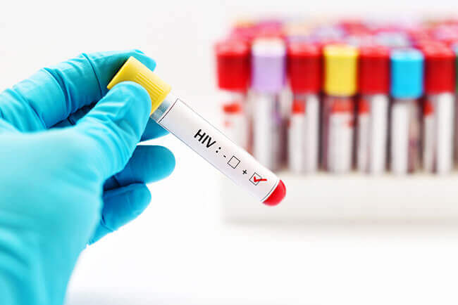 Everything You Need To Know About HIV Testing