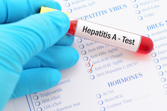 Everything You Need To Know About Hepatitis A Testing